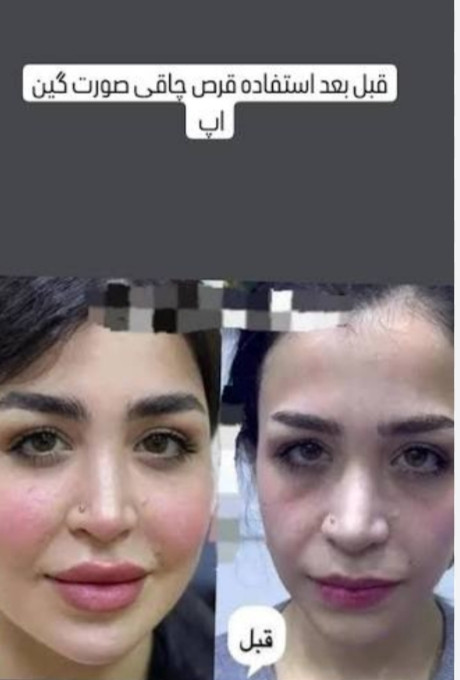 حجم دهنده صورت و گونه گیاهی اورجینال 65عددی