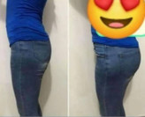 قرص حجمدهی و فرمدهی باسن گیاهی به شرط اصل کیفیت عالی