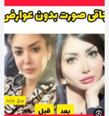 مکمل حجم دهنده صورت و بدن 65عددی اورجینال(۲ قوطی)