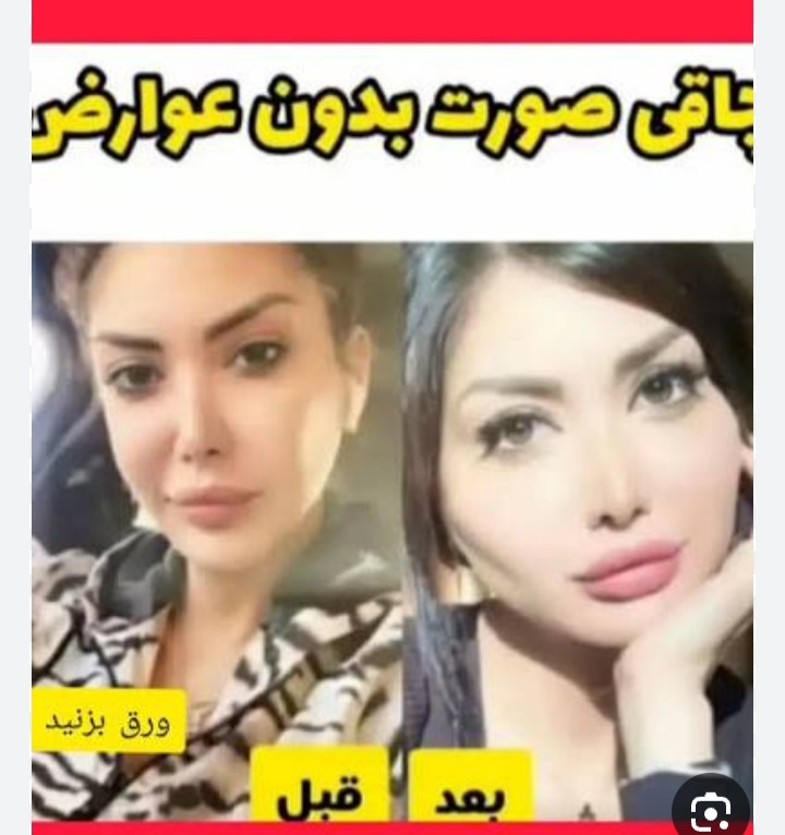 قرص چآقیٖ صورت نقرهای اورجینال