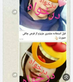 قرص چآقیٖ صورت نقرهای اورجینال