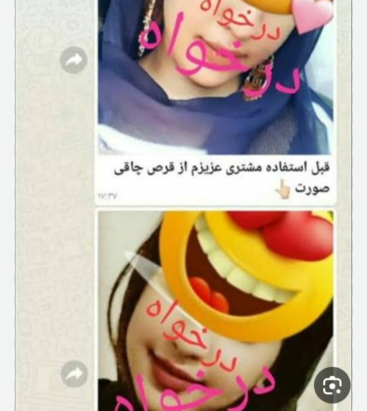 قرص چآقیٖ صورت نقرهای اورجینال