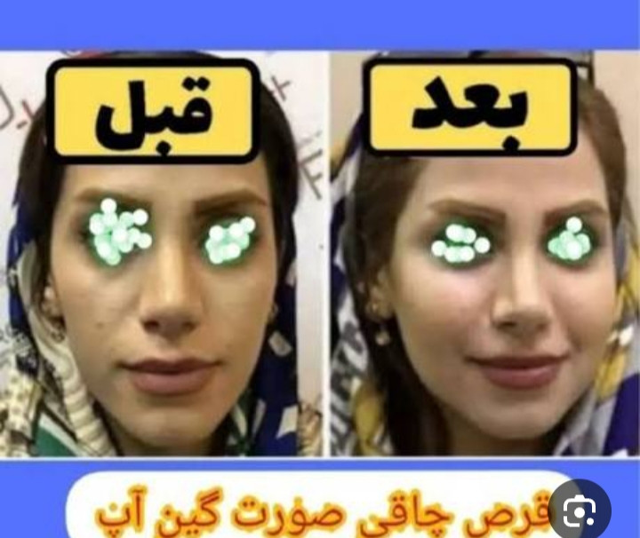قرص چآقیٖ صورت نقرهای اورجینال