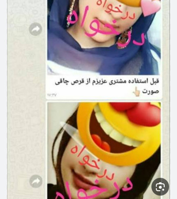 قرص چآقیٖ صورت نقرهای اورجینال